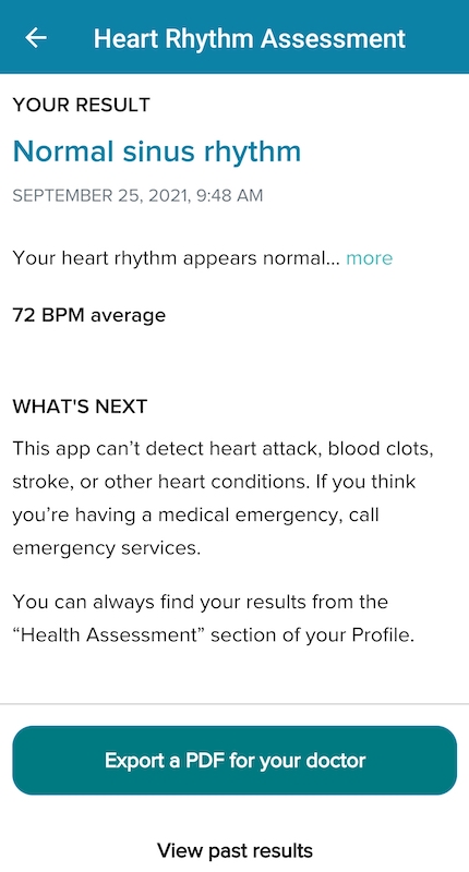 FitbitSense